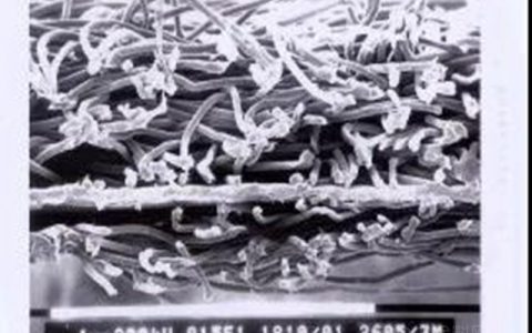 东方雨虹 防水透汽膜——让您的房子会“呼吸”